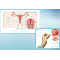 Male &amp; female Oral Sampling &amp; Nasal Sampling &amp; Urethra-Infektion Sampling Probe Beflockten Tupfer